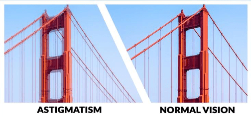 Astigmatism vs Normal Vision
